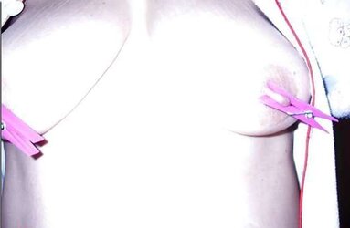 Scorching Susana