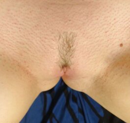 Yet more waxed vagina