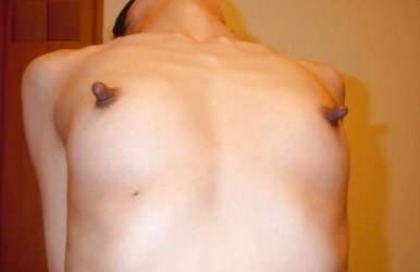 Puffies : Some large ones and Some Rock Hard ones.