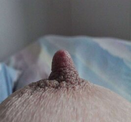 Puffies : Some large ones and Some Rock Hard ones.