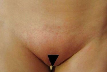 More vajazzling