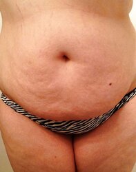 Chubby addiction