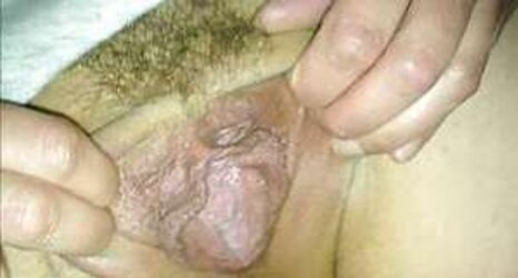 Fotzen und Kitzler Bilder