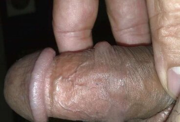 Malay Furry Vulva Pulverized Suffering Hard-On Part