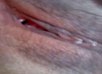 Malay Furry Vulva Pulverized Suffering Hard-On Part