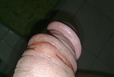 Malay Furry Vulva Pulverized Suffering Hard-On Part