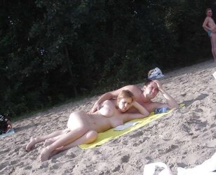 I have sunburned boobs