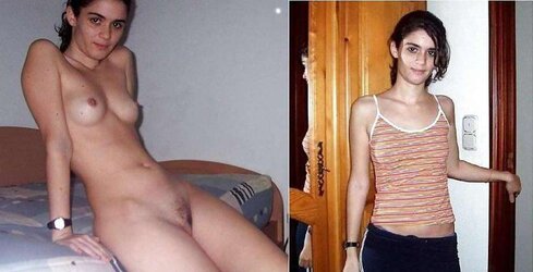 Before After 172.