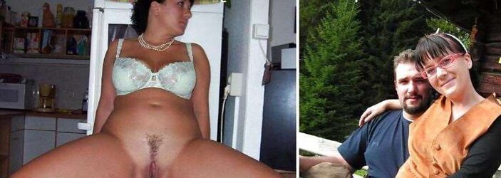 Before After 172.