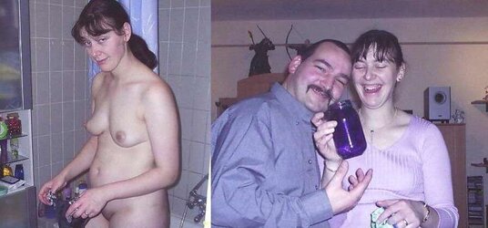 Before After 172.