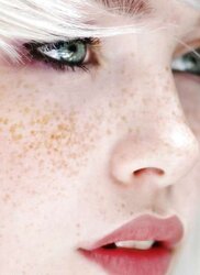 Freckless Rote. Hausbesuche NRW