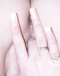 Teenager Congenital Total Gallery
