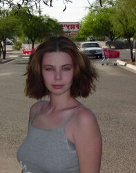 Teenager Congenital Total Gallery
