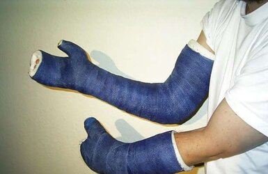 Gips - Cast
