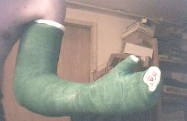 Gips - Cast