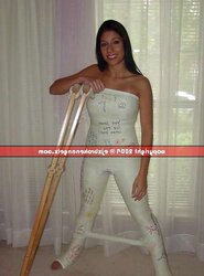 Gips - Cast