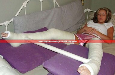 Gips - Cast