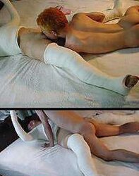 Gips - Cast