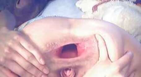 Bestanalxx Giant Assfuck gape time
