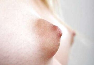 Hangers selection: little - congenital - giant