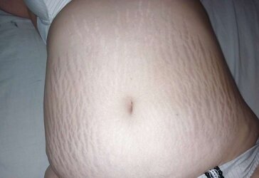 Screw and breed my spread marks