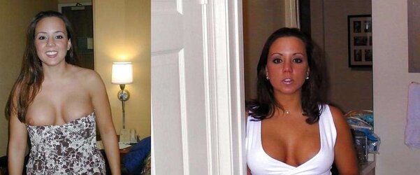 Before After 58.