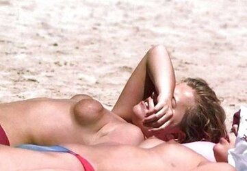 Deformed and saggy titts