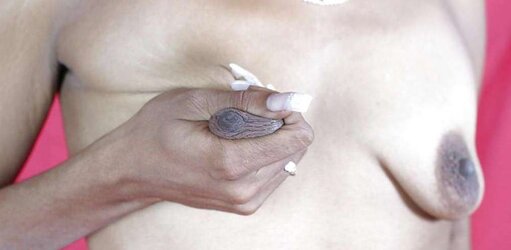 Deformed and saggy titts