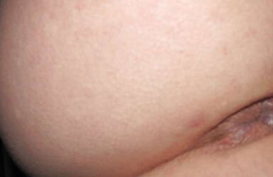 Restrain Bondage rectal