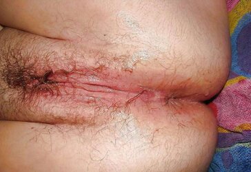 Fledgling Mature Culos and Butt Holes Vol