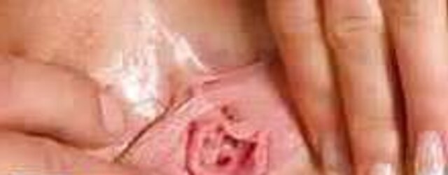 Defloration