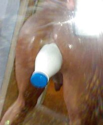 Dilatation - Rectal