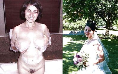 Before After 122.