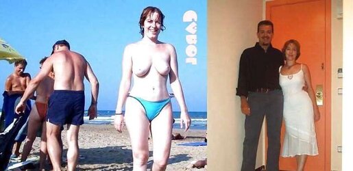 Before After 122.