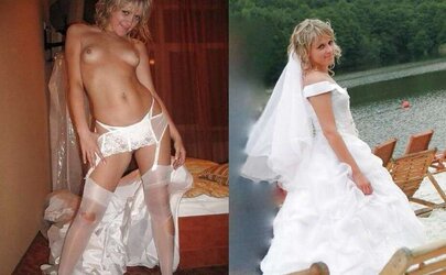 Before After 122.