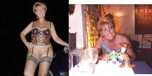 Before After 122.