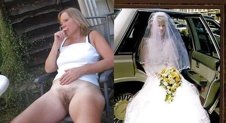 Before After 122.