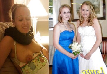 Bridal then bare Set