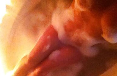 MUMMY Self Shots