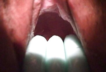 Flowers Muddler in vulva