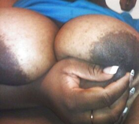 Massive dark-hued areolas ---huge bevy part