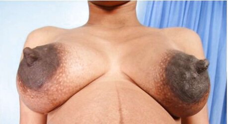 Massive dark-hued areolas ---huge bevy part