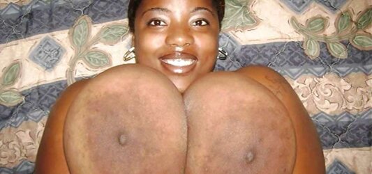 Massive dark-hued areolas ---huge bevy part