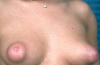 Some cute nips