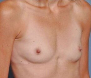 Super-Hot looking knockers