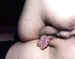 Grosse schamlippen