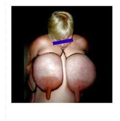 If only gigantic areolas