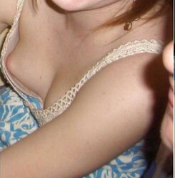 Downblouse and nipslip