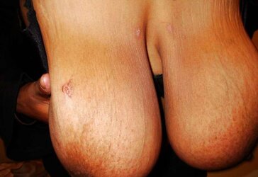 Phat Ebony Boobs and Arse