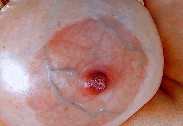 What Would You Do With These Huge Nips???!!!!